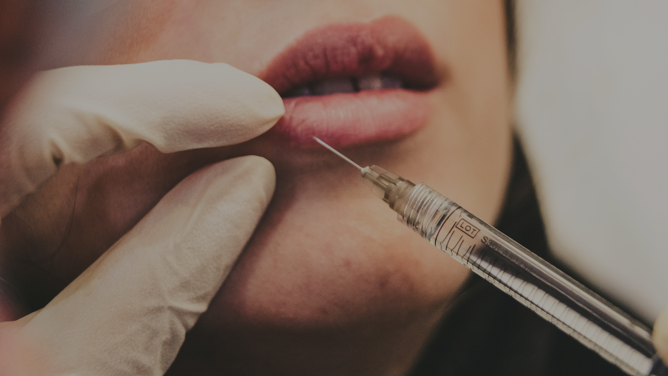 A Slippery Slope: Fillers, Botox, & Surgery